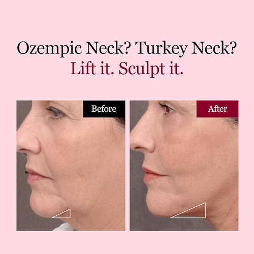 LiftPatch™ Jawline Sculpting Mask