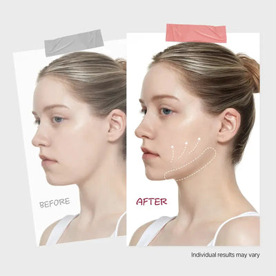 LiftPatch™ Jawline Sculpting Mask