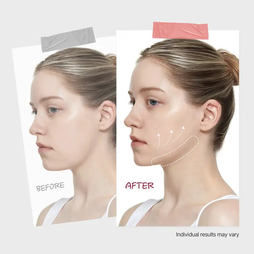 LiftPatch™ Jawline Sculpting Mask